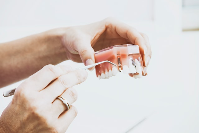 Rodzaje implantów zębowych