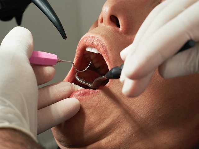 Wizyta kontrolna u dentysty – jak często powinna się odbywać?